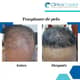 Slider image (9) Clinica Capilar